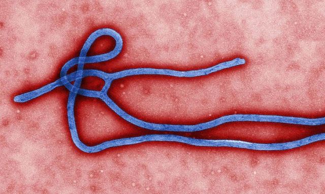 csm ebola virus virion 887a821699 Novo surto de ebola na Guiné