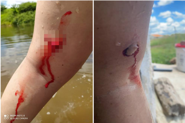 ataque piranhas Casal é atacado por piranhas em Rio que passa em Jardim de Piranhas (RN)