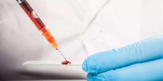 relacao com É bom que você saiba: O que a ciência já sabe sobre a relação entre Covid-19 e grupos sanguíneos