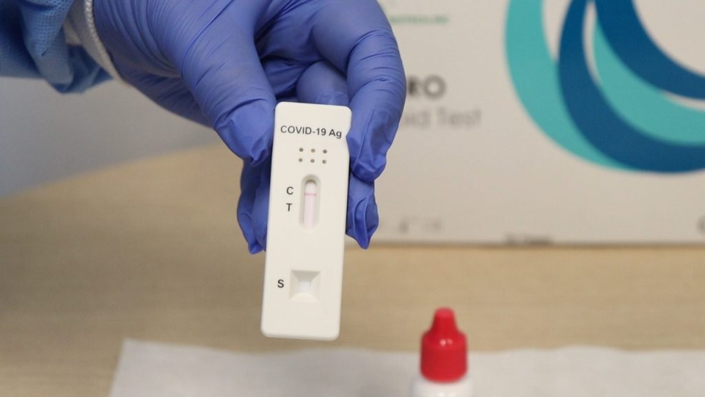 Anvisa concede o 1º registro de autoteste para Covid-19 no Brasil