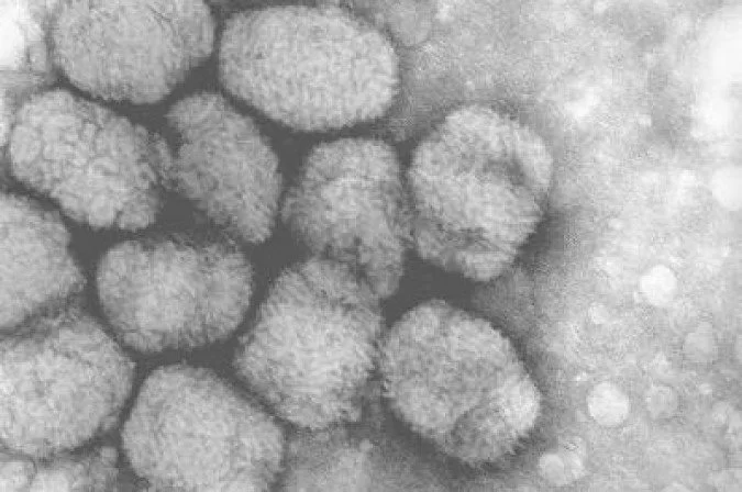 Varíola de macacos: brasileiro é 1º diagnosticado com a doença na Alemanha