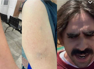 Jovem agredida constitui advogada e inicia processo criminal contra bolsista do IDEMA